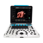 DW P30 Portable 3D/4D Color Doppler Ultrasound System