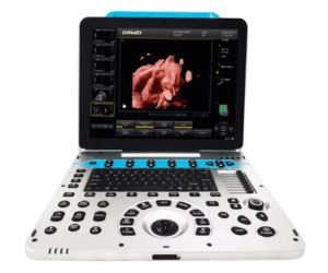 DW P30 Portable 3D/4D Color Doppler Ultrasound System